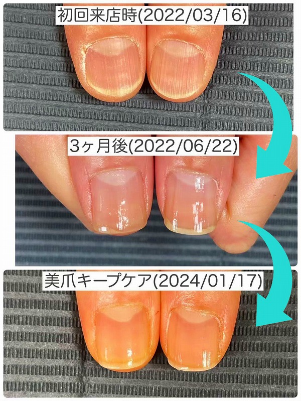 美爪育成001