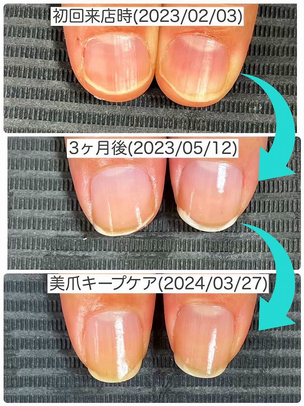 美爪育成003