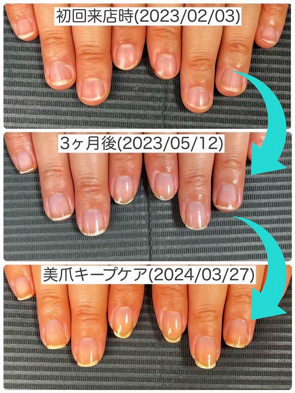 美爪育成005