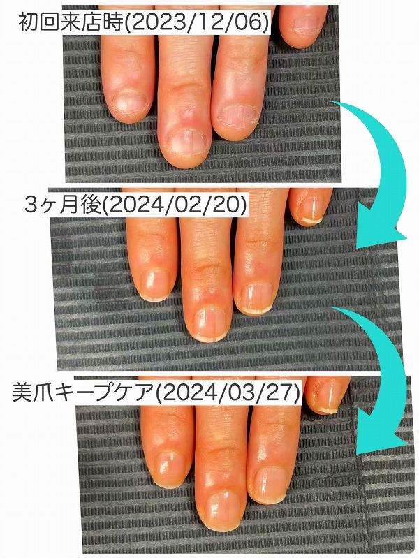 美爪育成008